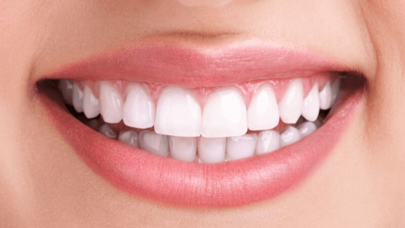Alice Perfect Smile - Clinica stomatologica Bucuresti