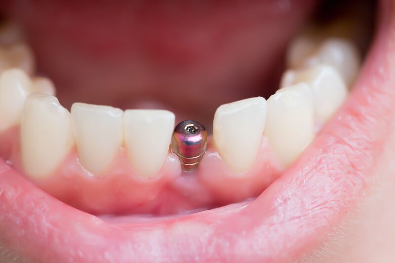 Alice Perfect Smile - Clinica stomatologica Bucuresti