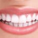 Alice Perfect Smile - Clinica stomatologica Bucuresti
